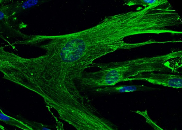 Recombinant CD13/ANPEP Monoclonal Antibody (AN300043P)