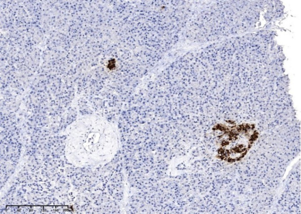 Recombinant Insulin Monoclonal Antibody (AN300052P)