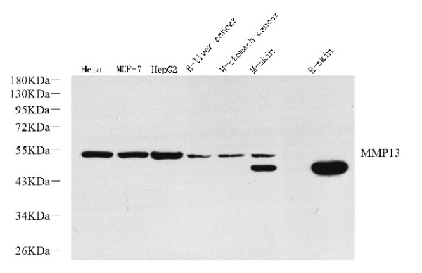 MMP13 Polyclonal Antibody (E-AB-70346)
