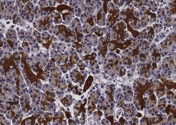 Recombinant Ephrin-A1/EFNA1 Monoclonal Antibody (AN300352P)