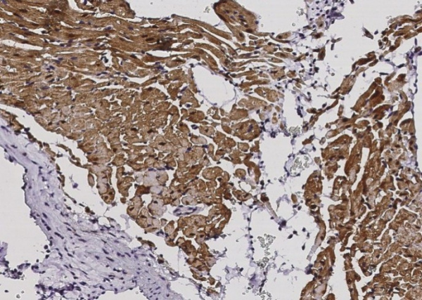 Recombinant S100A1 Monoclonal Antibody (AN300114P)