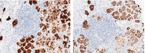 Pepsinogen C/PGC Monoclonal Antibody (AN200124P)