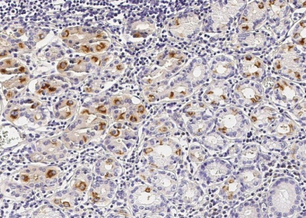 Recombinant VE-Cadherin/CD144 Monoclonal Antibody (AN300185P)