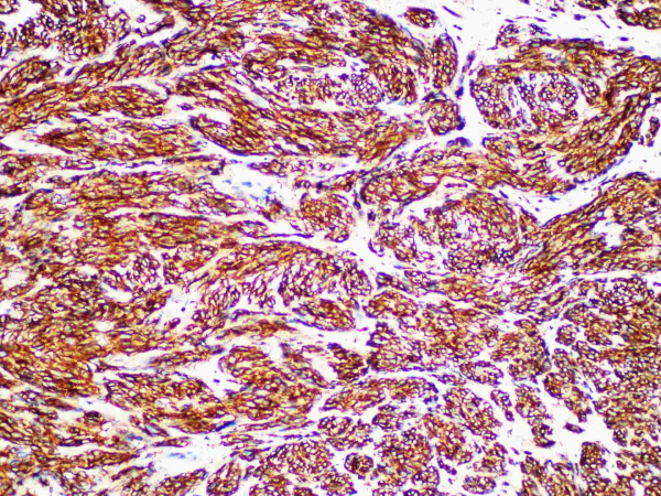CD117/c-Kit Monoclonal Antibody (ELAB6946-R)