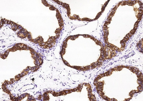 Recombinant NPC2 Monoclonal Antibody (AN300055P)