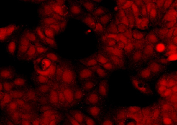 Recombinant OTUB2 Monoclonal Antibody (AN300435P)