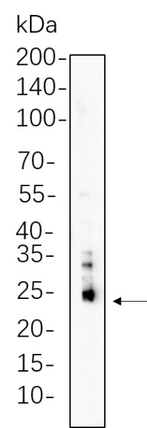 Recombinant Bim Monoclonal Antibody (AN300812L)