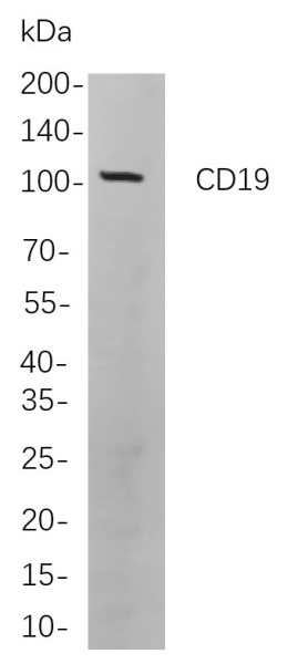 Recombinant CD19 Monoclonal Antibody (AN301114L)
