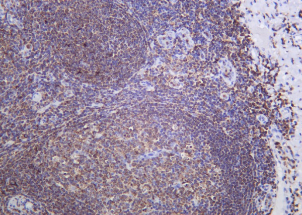 Recombinant SH-PTP1 Monoclonal Antibody (AN301193L)