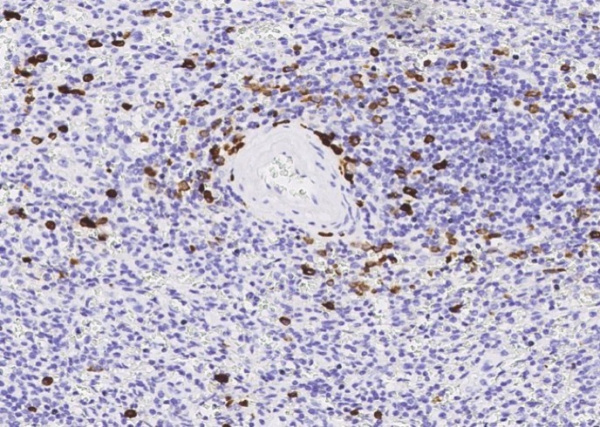 Recombinant PERP1/MZB1 Monoclonal Antibody (AN300286P)