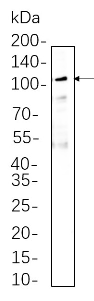 Recombinant MMP9 Monoclonal Antibody (AN301378L)