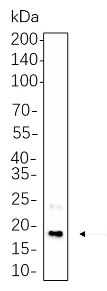 Recombinant CENP-A Monoclonal Antibody (AN300654L)