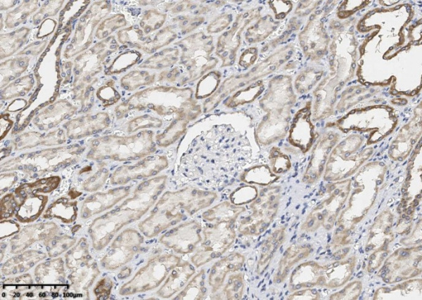 Bcl-XL Monoclonal Antibody (AN200246P)