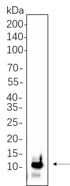 Recombinant UBA52 Monoclonal Antibody (AN300653L)