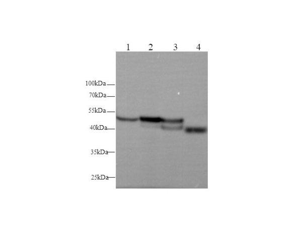 Serpina1 Polyclonal Antibody (D-AB-10209L)
