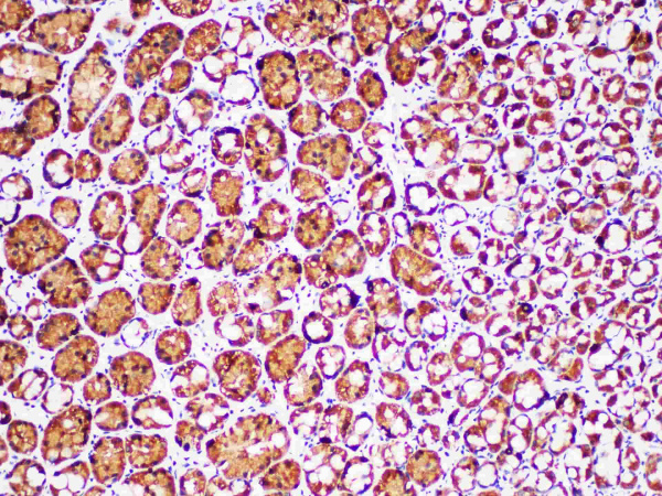 SDHB Monoclonal Antibody (ELAB6974-R)