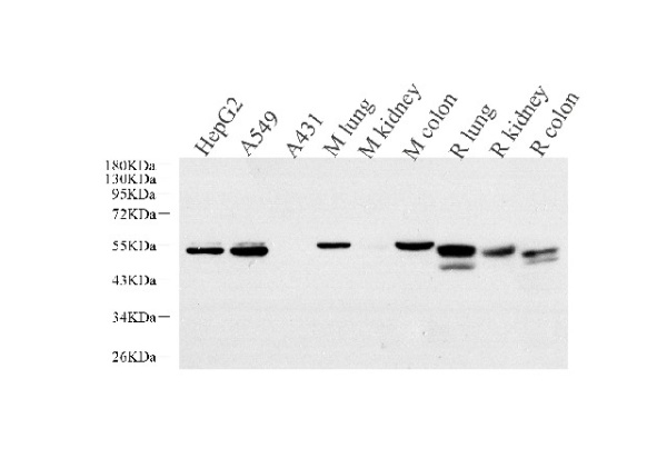 CK-7 Monoclonal Antibody (E-AB-70293)