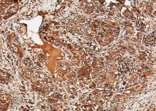 Recombinant ULBP2/N2DL-2 Monoclonal Antibody (AN300137P)