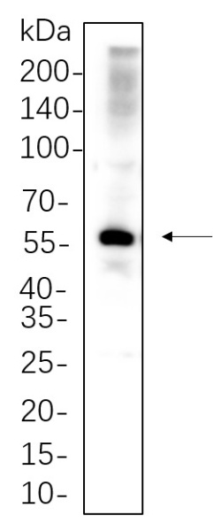 Recombinant PAX-8 Monoclonal Antibody (AN300690L)