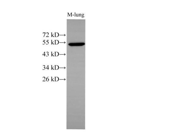 CK-7 Polyclonal Antibody (D-AB-10175L)