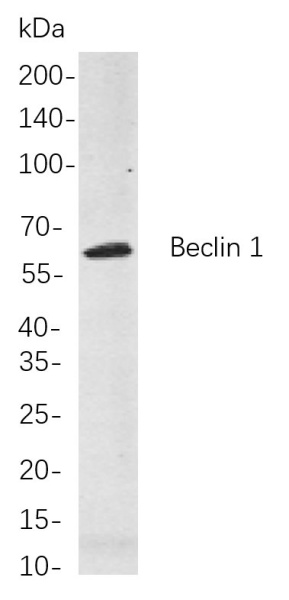 Recombinant Beclin 1 Monoclonal Antibody (AN300842L)