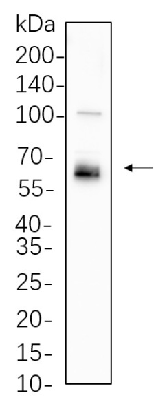 Recombinant LKB1 Monoclonal Antibody (AN300823L)