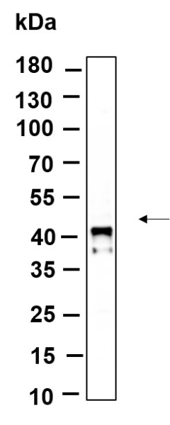 Recombinant Phospho-IκB-α (Ser32) Monoclonal Antibody (AN301182L)