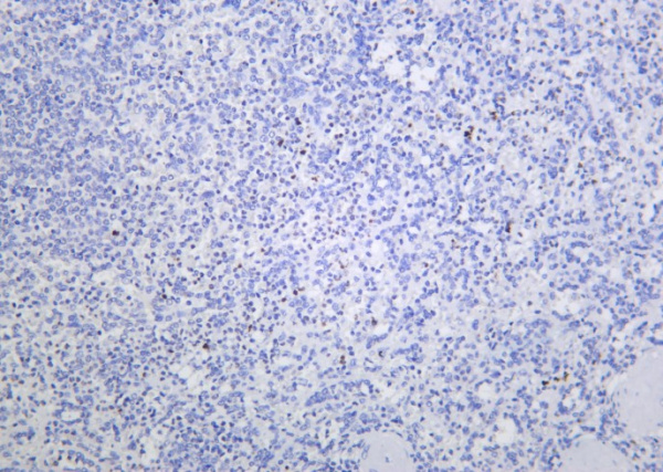 Recombinant Histone H4 (Acetyl Lys16) Monoclonal Antibody (AN301395L)
