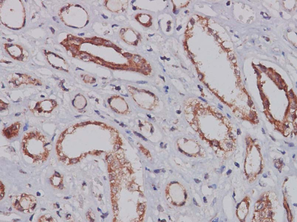 CXCL14 Polyclonal Antibody (AN006120L)
