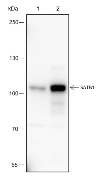 Recombinant SATB1 Monoclonal Antibody (AN301652L)