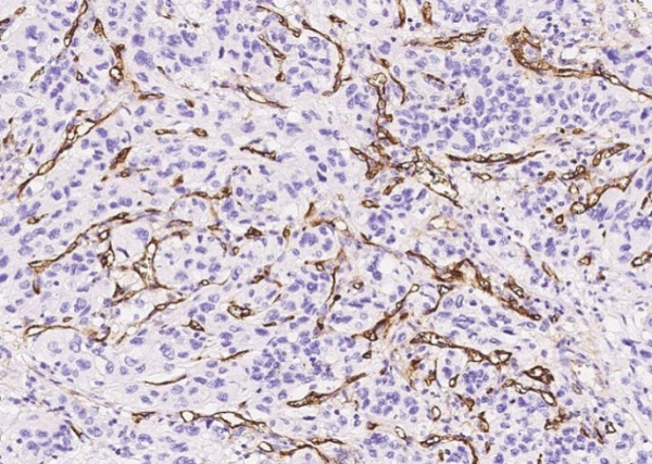 Endoglin/CD105 Monoclonal Antibody (AN200002P)
