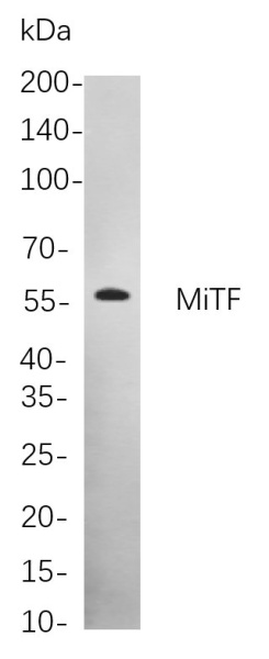 Recombinant MiTF Monoclonal Antibody (AN301081L)