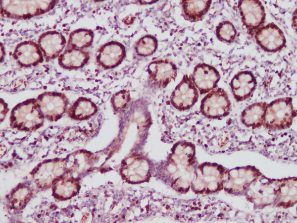 Ki67 Polyclonal Antibody (AN004340L)