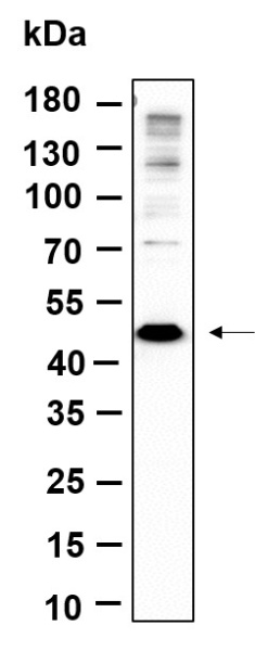 Recombinant Methionyl Aminopeptidase 1 Monoclonal Antibody (AN301239L)