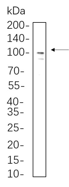 Recombinant Sodium Potassium ATPase Monoclonal Antibody (AN300610L)