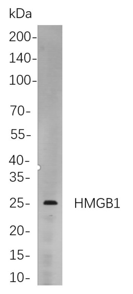 Recombinant HMGB1 Monoclonal Antibody (AN300860L)