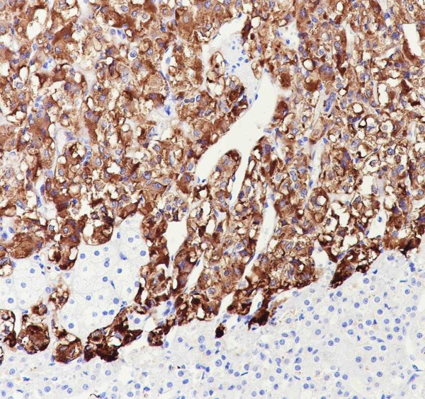 Recombinant Dopamine beta Hydroxylase Monoclonal Antibody (AN301975L)