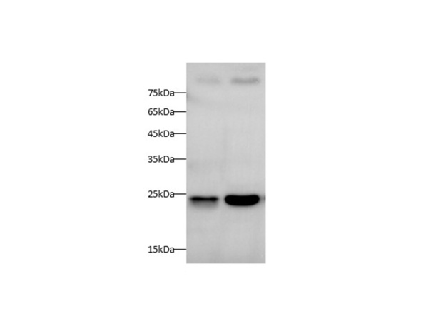 SOD2 Polyclonal Antibody (D-AB-10436L)
