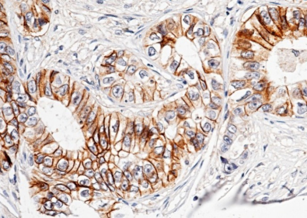 Recombinant Cadherin-17/LI-cadherin/CDH17 Monoclonal Antibody (AN300232P)