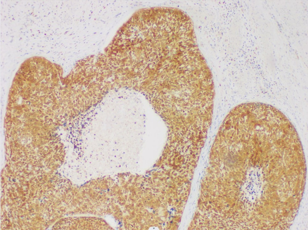 GST-P Monoclonal Antibody (ELAB6978-M)