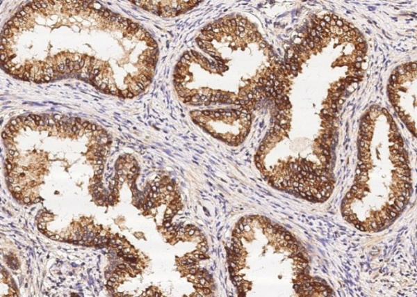 Recombinant ENTPD5 Monoclonal Antibody (AN300225P)