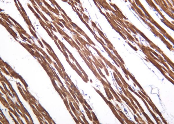 Recombinant SERCA2 Monoclonal Antibody (AN301264L)