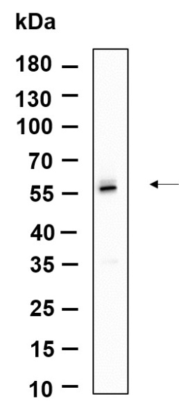 Recombinant TRAF2 Monoclonal Antibody (AN301172L)