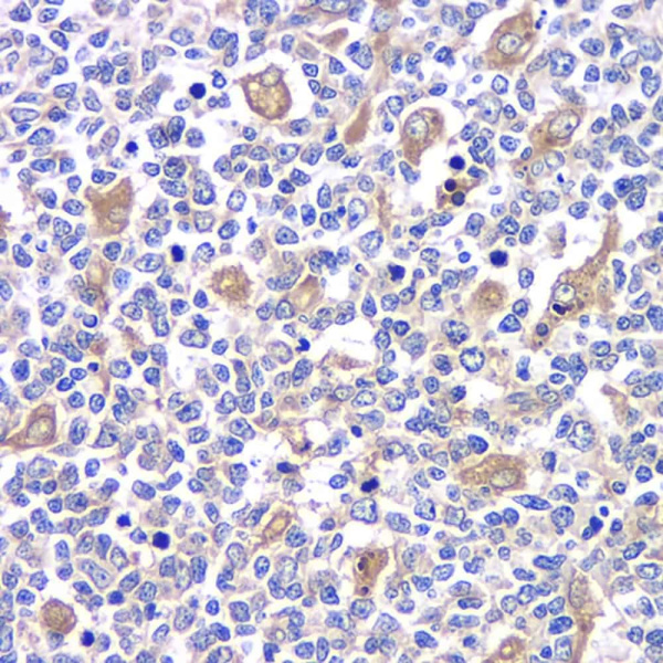 TLR9 Polyclonal Antibody (E-AB-70125)