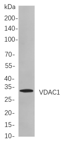 Recombinant VDAC1 Monoclonal Antibody (AN300968L)