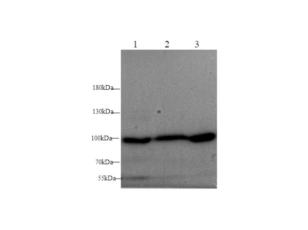 ST14 Polyclonal Antibody (D-AB-10208L)