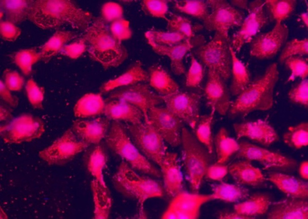 Recombinant SPARCL1/SPARC-like 1 Monoclonal Antibody (AN300038P)