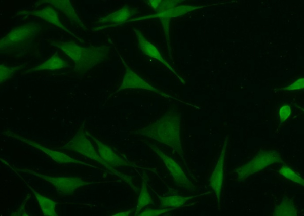 CMPK1 Monoclonal Antibody (AN200236P)