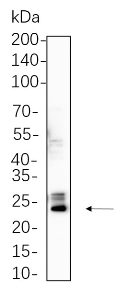 Recombinant Bak Monoclonal Antibody (AN300828L)