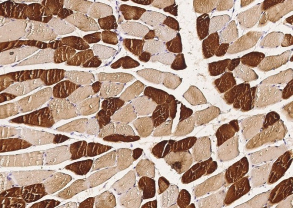 Recombinant ENO3/beta-enolase Monoclonal Antibody (AN300096P)